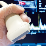 Transthoracic-Echocardiography-(TTE)