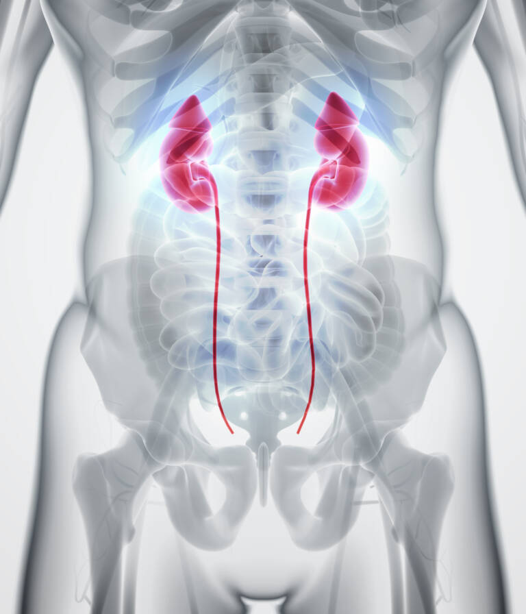 Kidney Disease Specialists