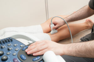 varicose vein treatment