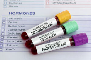 Thyroid Hormone Replacement