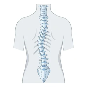 Scoliosis: