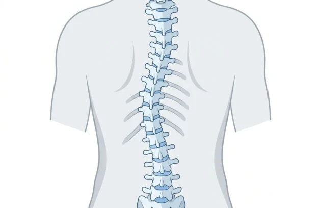 Scoliosis: