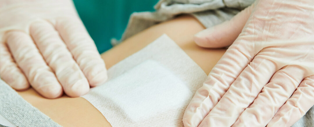 The Role of Blood Circulation in Wound Healing