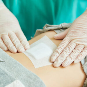 The Role of Blood Circulation in Wound Healing