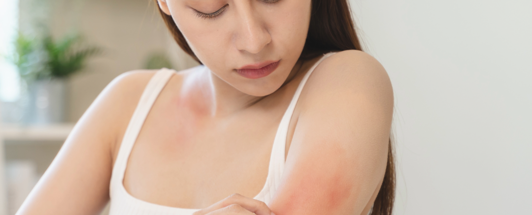 Advances in Biologics for Severe Allergic and Autoimmune Conditions