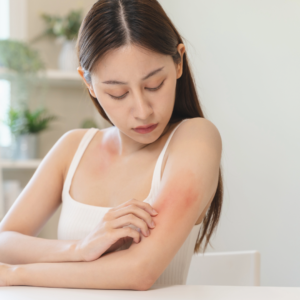 Advances in Biologics for Severe Allergic and Autoimmune Conditions