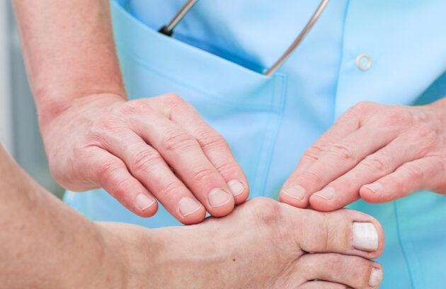 Minimally Invasive Surgery for Hallux Valgus: Techniques and Outcomes