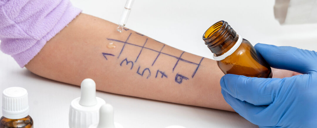 Understanding Histamine Intolerance: More Than Just Seasonal Allergies