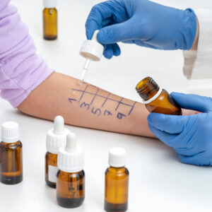 Understanding Histamine Intolerance: More Than Just Seasonal Allergies