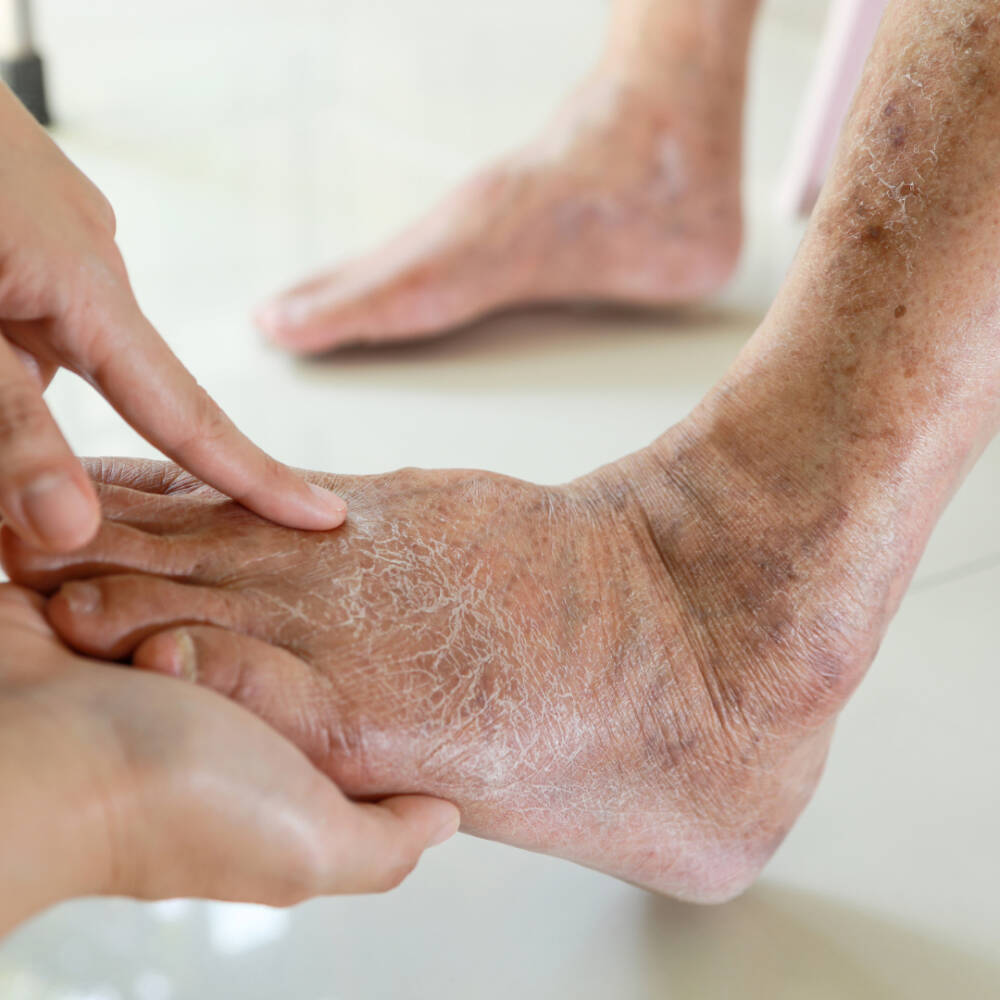 What causes numbness in the feet and when to see a doctor