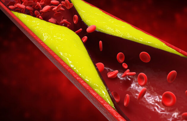 How to Prevent Blood Clots When Traveling Long Distances